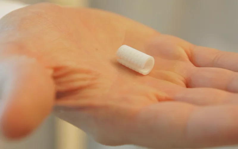 The ridged tube-shaped splint was sewn around Kaiba’s airway, opening up his bronchus and serving as a skeleton to guide the proper growth of more rigid cartilage