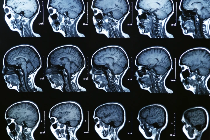 Brain scans could help scientists and lawyers determine a suspect's criminal intent