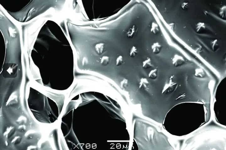 A scanning electron microscope image of the nanowire-alginate composite scaffolds, showing the star-shaped clusters of nanowires (Image: Disease Biophysics Group, Harvard University)