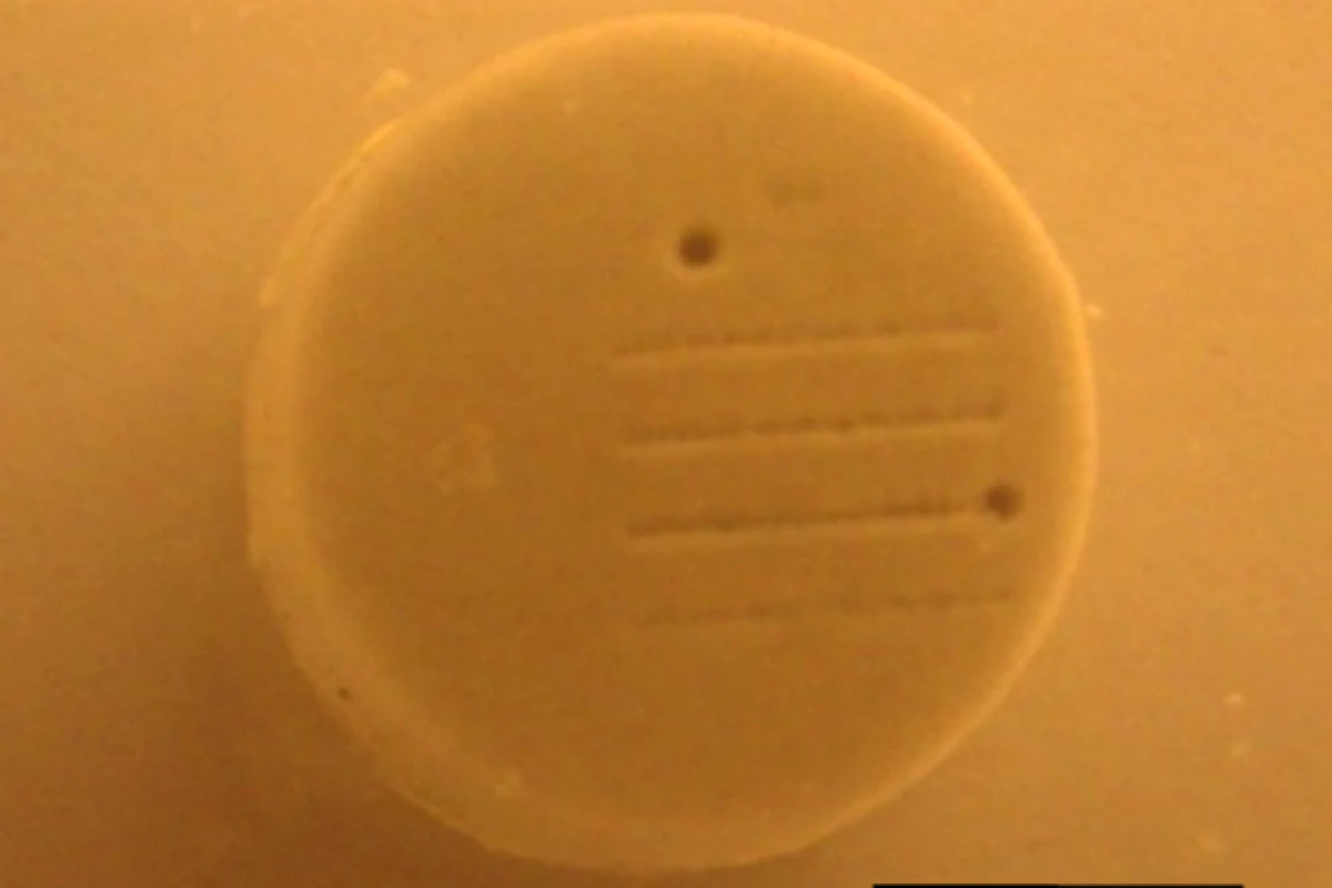 A confetti-sized artificial kidney stone, with a sub-150-micrometer hole bored into it using the focused sound beam