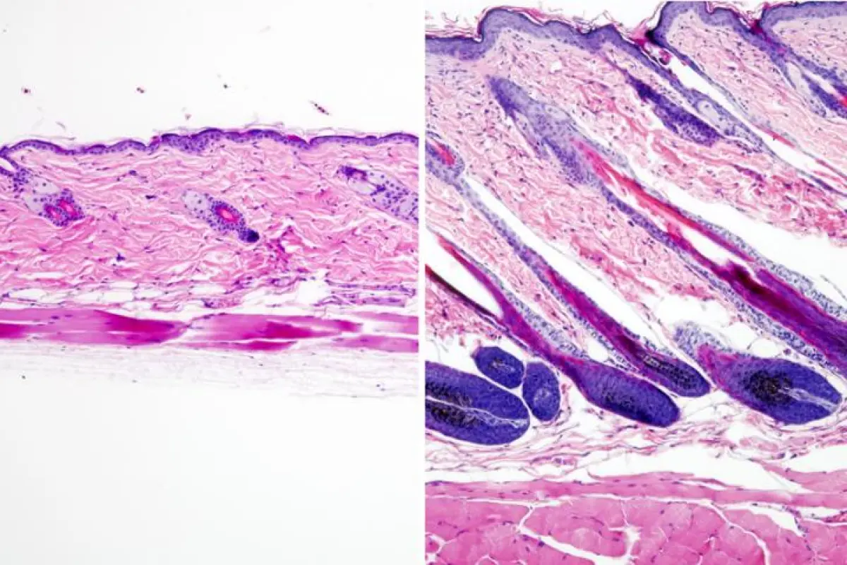 Untreated mouse skin on the left versus skin that was treated with the drug UK5099 on the right