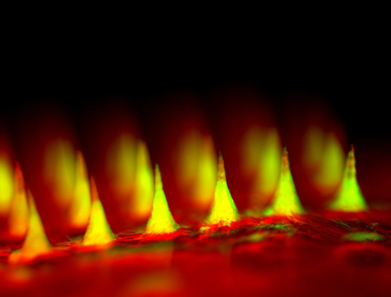 Closeup fluorescent image of the microneedle patch with insulin tagged in green