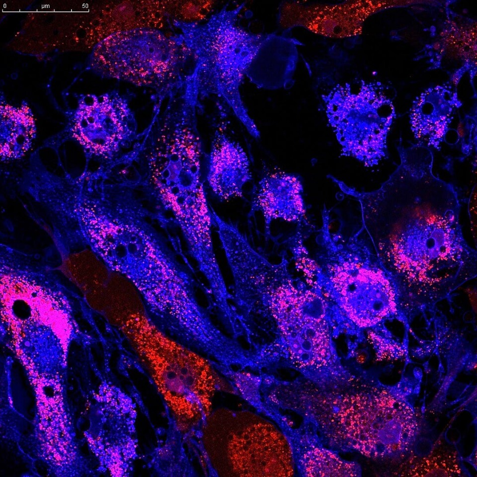 A landmark stem cell therapy to treat frailty in senior citizens is all set to move into the final phase of human clinical trials