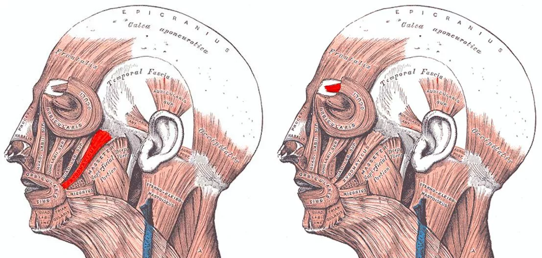 On the left hand head, the Zygomaticus facial muscle (smiling) is highlighted – on the right, the Corrugator supercilii facial muscle (frowning)