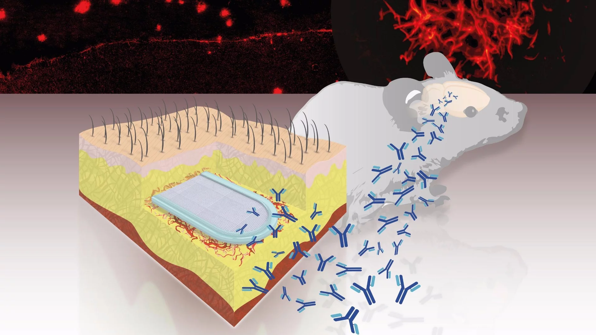 The tiny capsule has been found to prevent the build up of plaques in the brains of mice, and could one day provide a means of preventing Alzheimer's disease