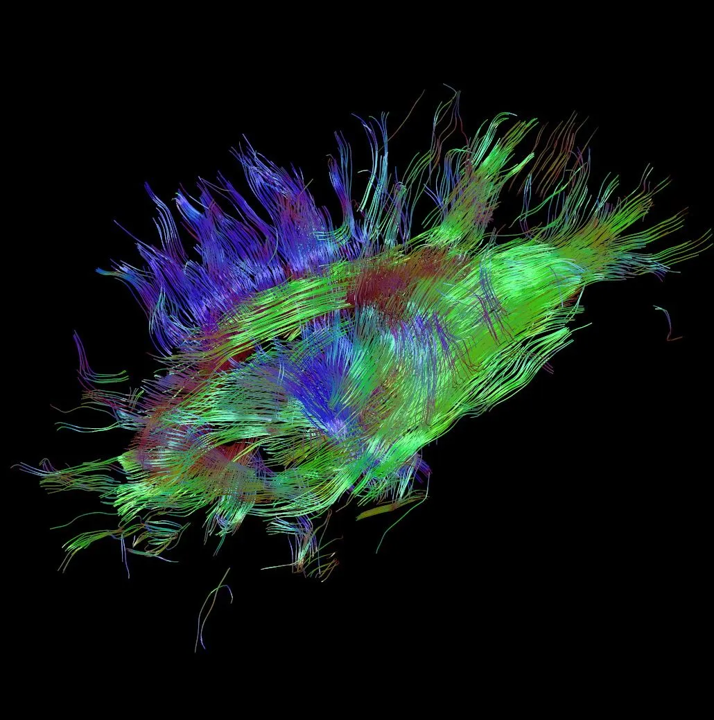 Software creates 3D wiring maps of the brain