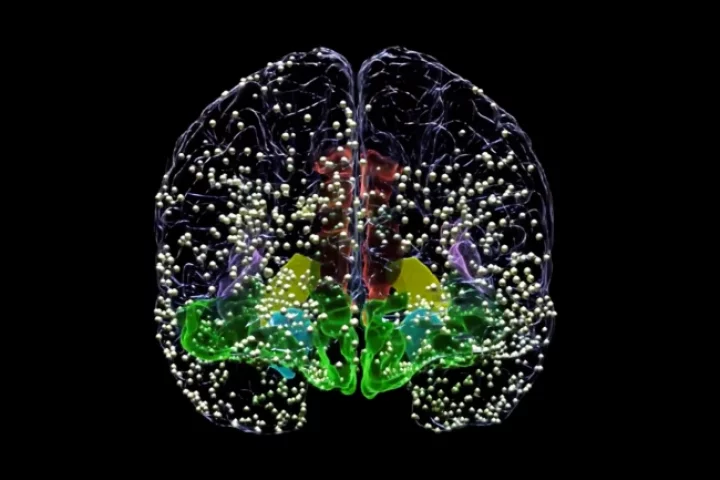 All the above dots represent the locations where electrodes were temporarily implanted as part of new research into the use of DBS to treat depression