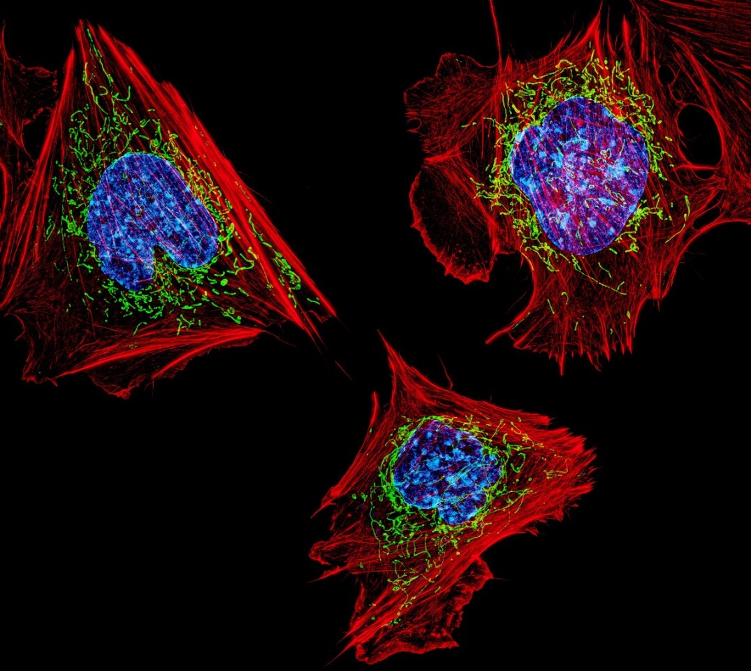 Research has found that a cell's mitochondria (represented in green above) can be affected through fasting, which results in better health and longevity