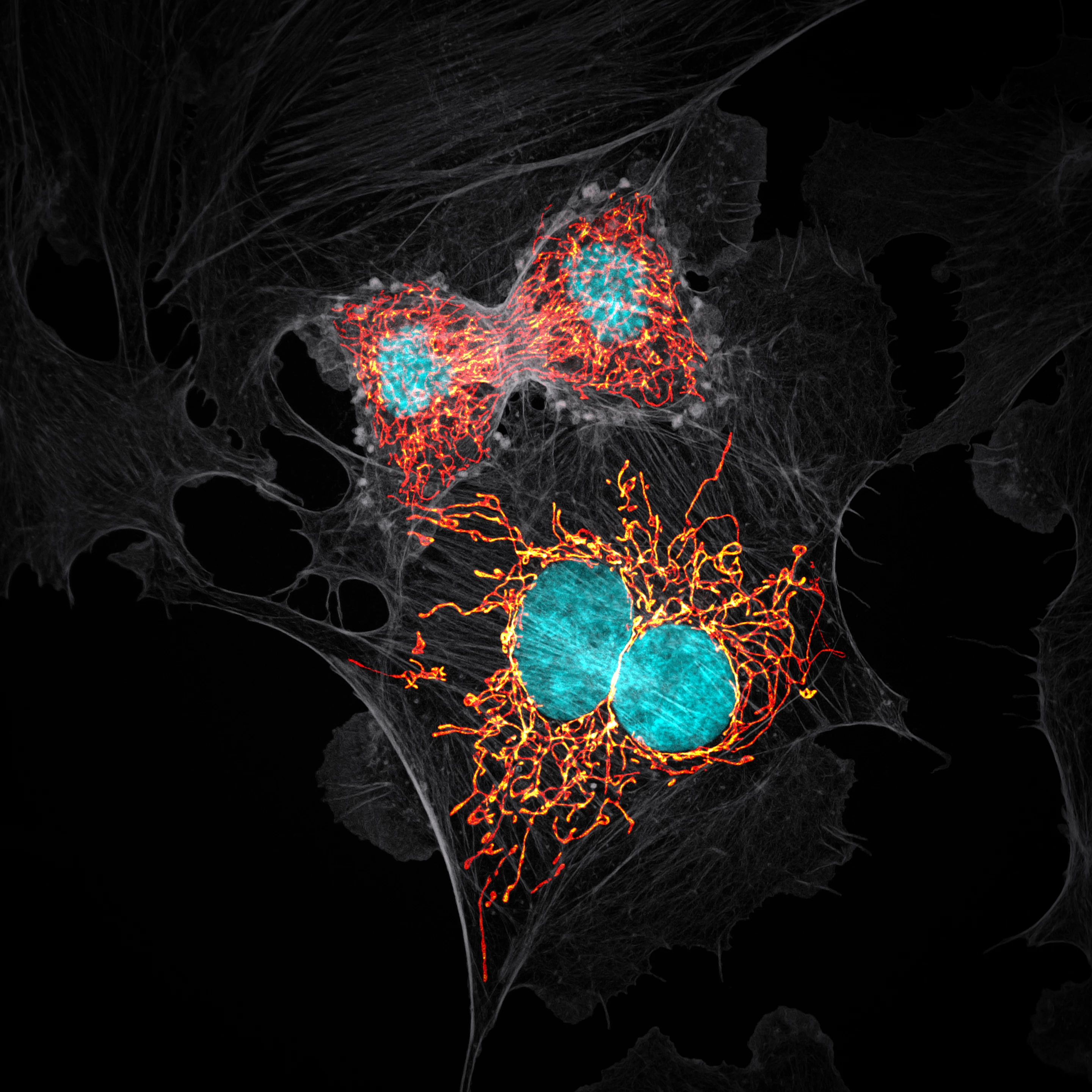 10th Place winner. BPAE cells in telophase stage of mitosis