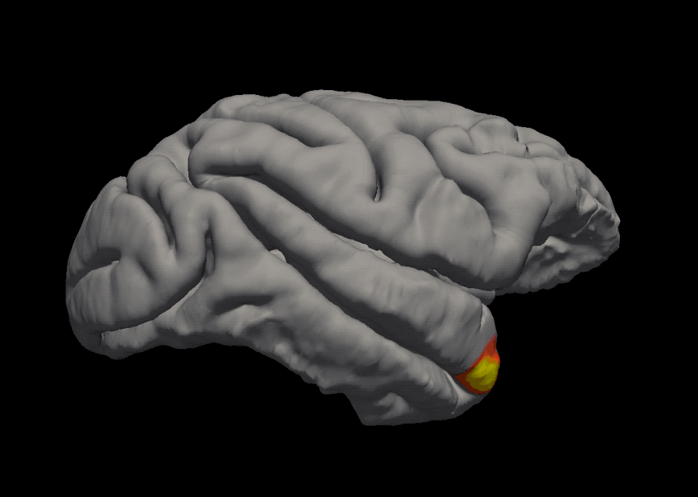 A brain scan showing the location of the temporal pole, a region that may be responsible for helping us recognize familiar faces