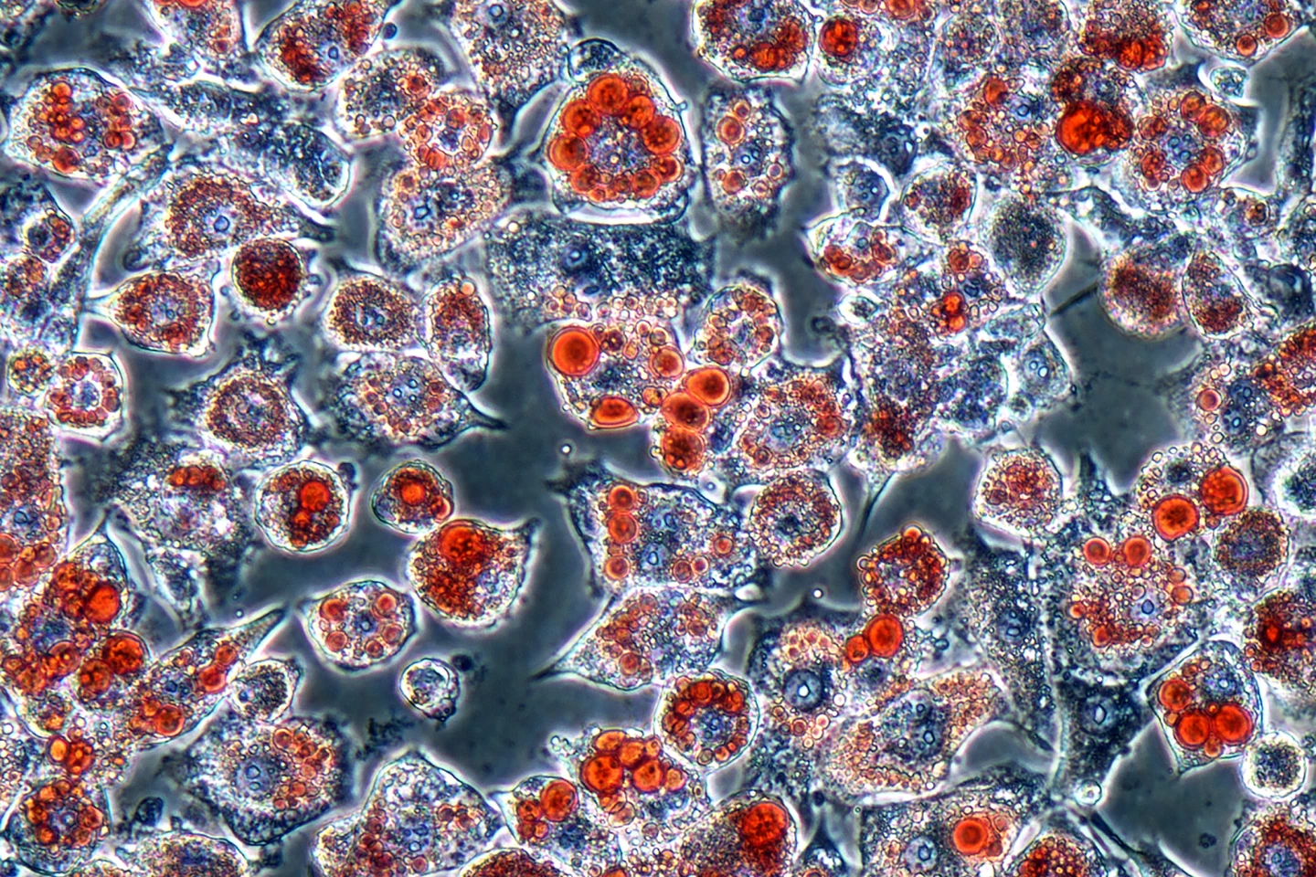 Adipocytes, or fat cells, with their lipid-transporting vesicles stained red