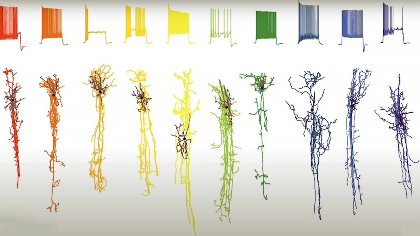 Researchers have created a 'pathology clock' of how brain cells are damaged by Alzheimer's disease over time