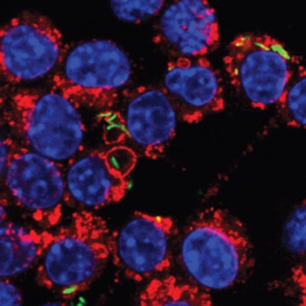 The nuclei of the macrophages are shown blue, while the phagosomes, which corral bacterial invaders, are shown in red
