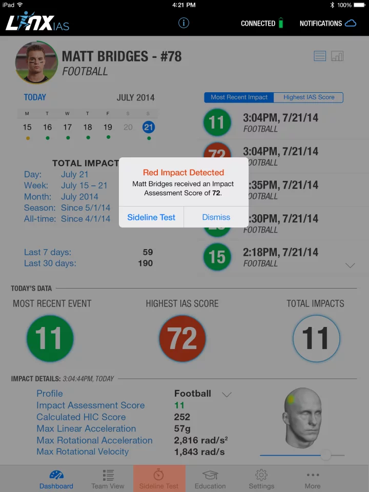 The Linx IAS app provides a simple 1 to 100 score that you can use to assess your likelihood of concussion