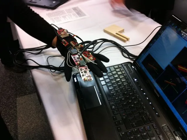 McGill University Biomedical Sensor Glove (Photo: McGill University)