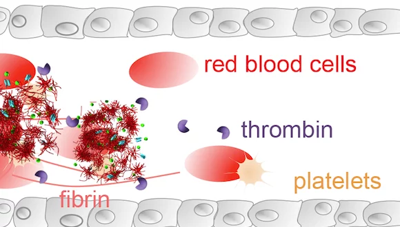 When it reaches the site, the thrombin bursts open the capsule's coating and sets the drug free