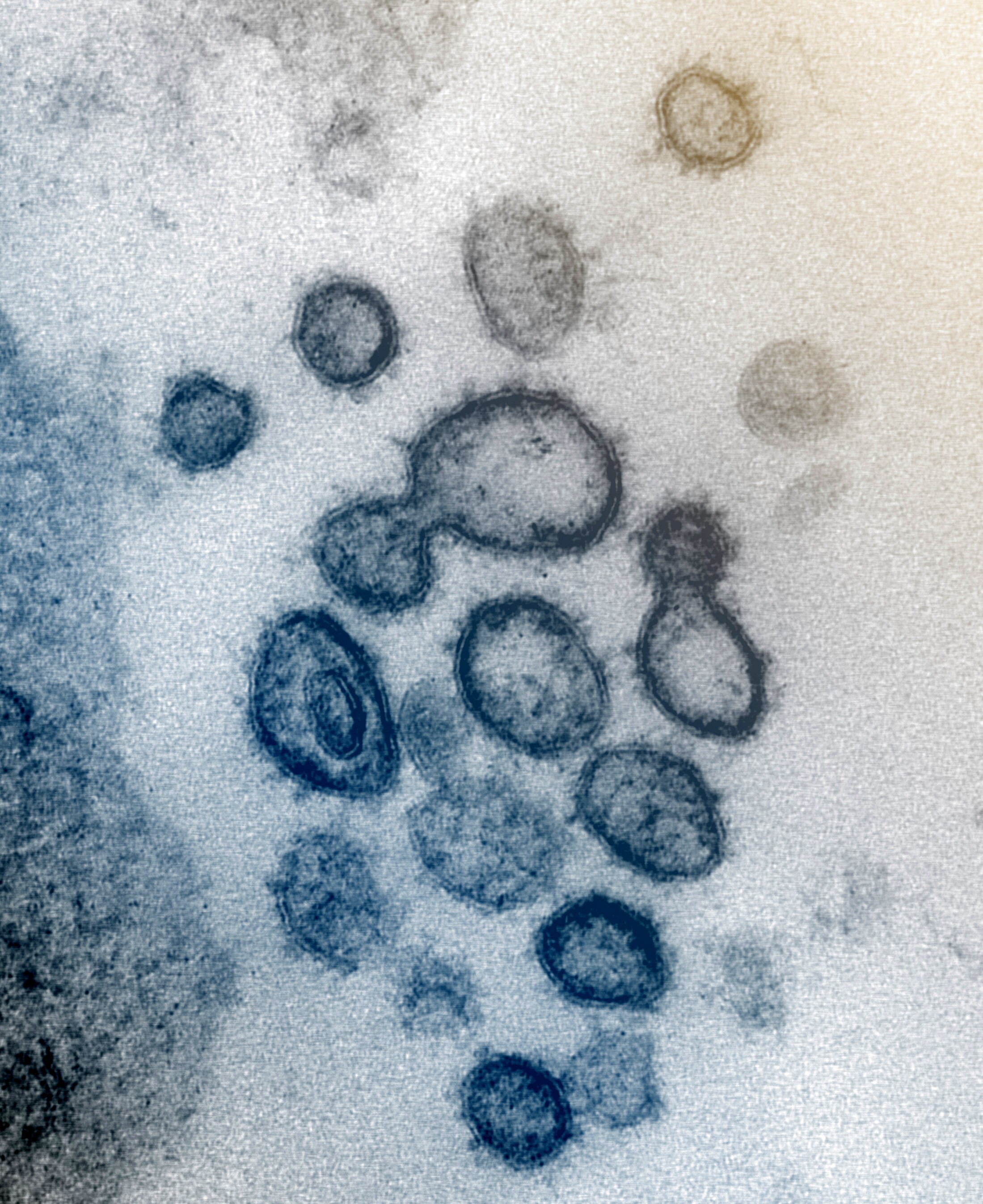 New, detailed images of novel coronavirus released by US lab