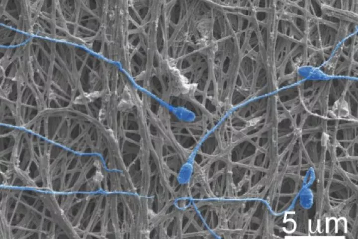 An electron microscope image of the fabric, complete with blocked sperm
