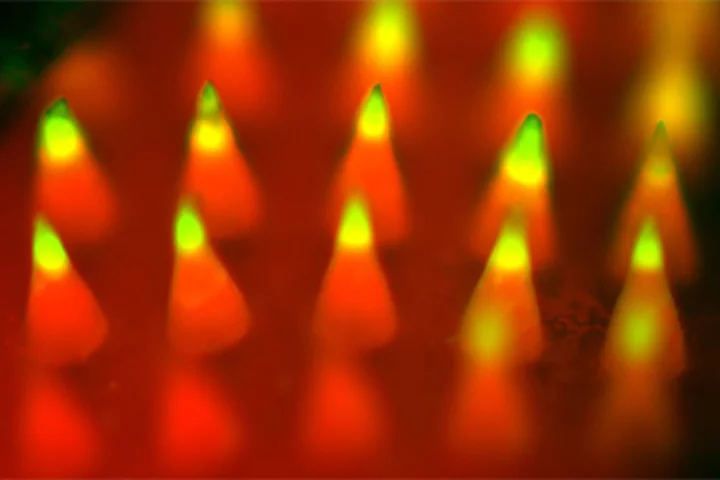 Fluorescence imaging of a microneedle patch