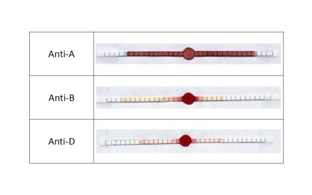 Detection of B blood group according to variations in blood viscosity as a result of antibody interaction on dry paper strips