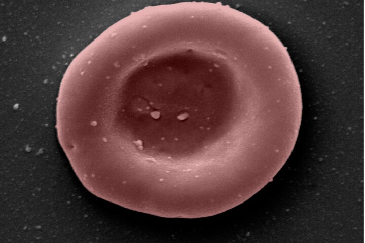 A microscope image of a red blood cell, grown in a lab