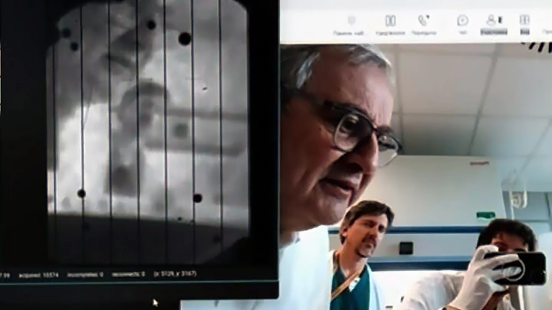 Captura de una videollamada médica donde un equipo de científicos observa una imagen en blanco y negro de una retina artificial o dispositivo ocular implantado, mientras uno de ellos toma una fotografía con una cámara.