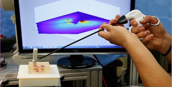 The capsule allows surgeons to measure tissue stiffness during minimally invasive surgery