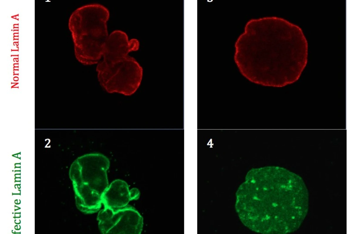 Methylene blue reversed the effects of progeria on cells