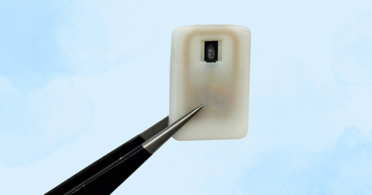 MIT engineers develop implant to combat hypoglycemia MIT engineers develop implant to combat hypoglycemia