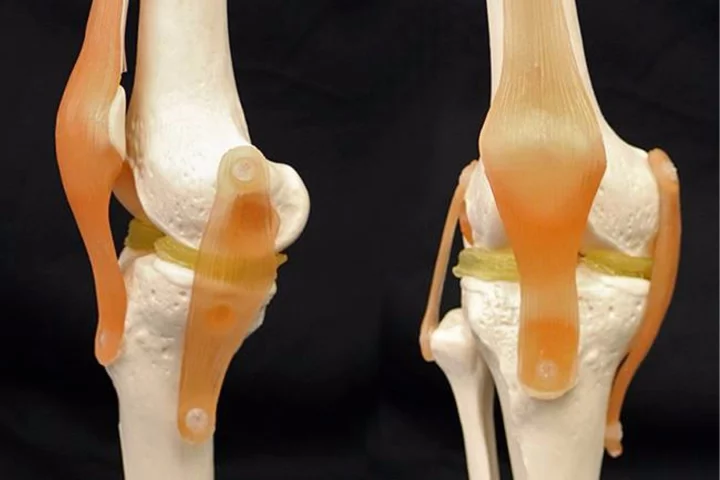 To demonstrate how their 3-D-printable, cartilage-mimicking material might work, the researchers used a US$300 3D printer to create custom menisci for a model of a knee