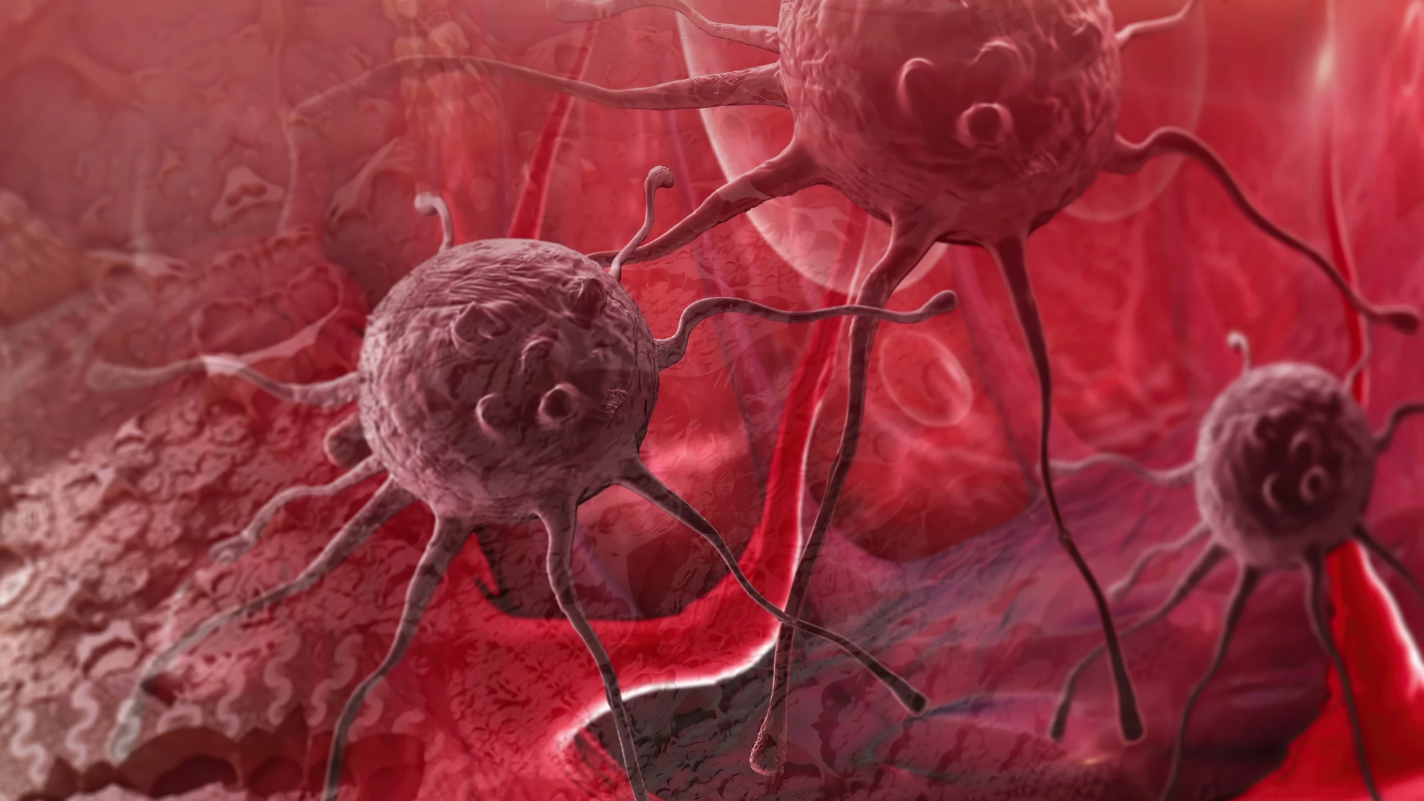 It's estimated a novel drug could help around five percent of patients with glioblastomas carrying a specific protein biomarker