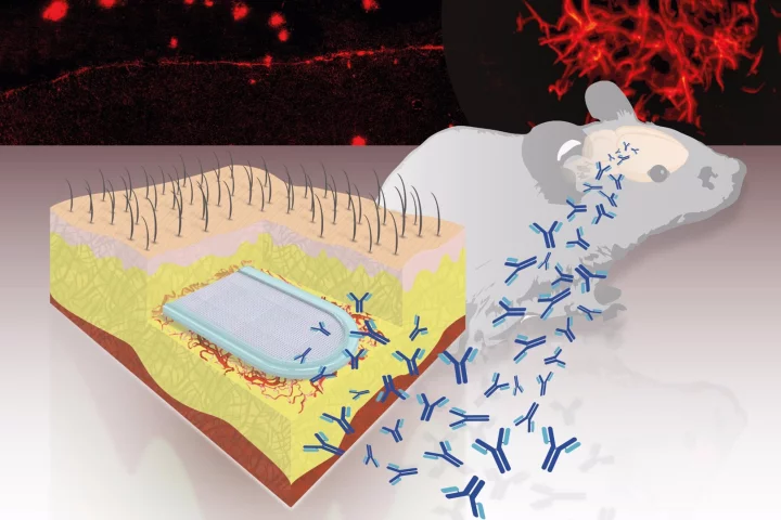 The tiny capsule has been found to prevent the build up of plaques in the brains of mice, and could one day provide a means of preventing Alzheimer's disease