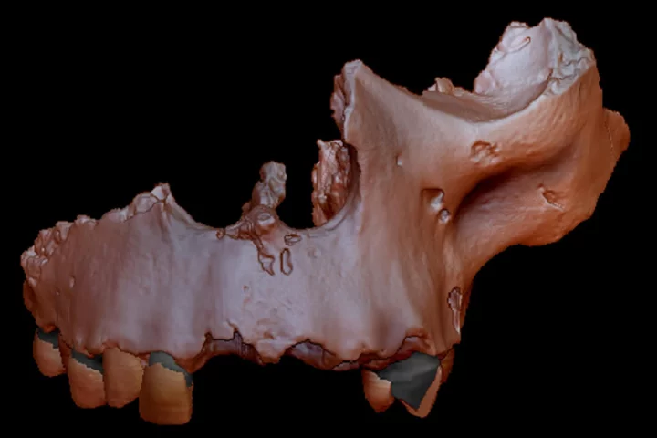A digital recreation of one of the main samples of Homo antecessor, which has now been placed on the family tree thanks to studies of ancient proteins in its teeth