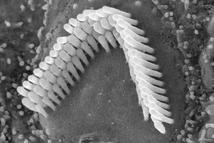 Hair cells like these have been successfully recreated in a petri dish (Photo: CC)