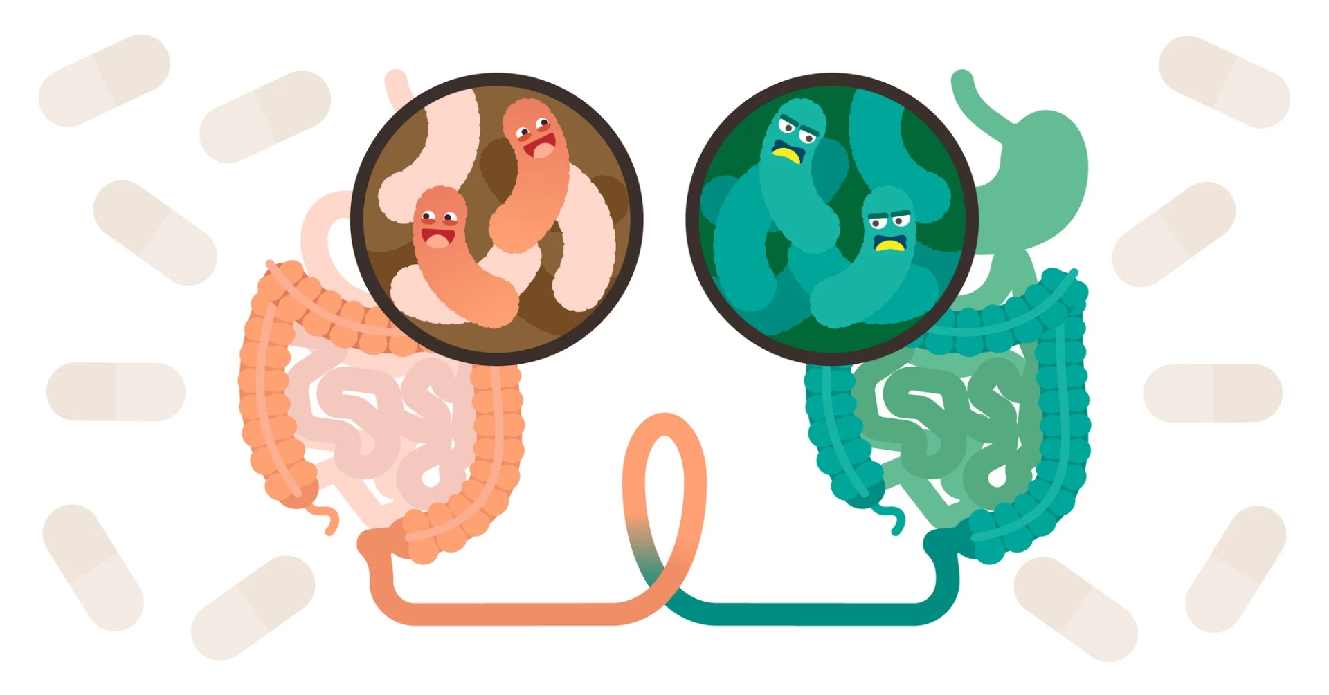 Despite no weight loss noted during the treatment period, a study into FMT to treat obesity did uncover certain microbiome changes occurring in the subjects receiving the fecal transplants