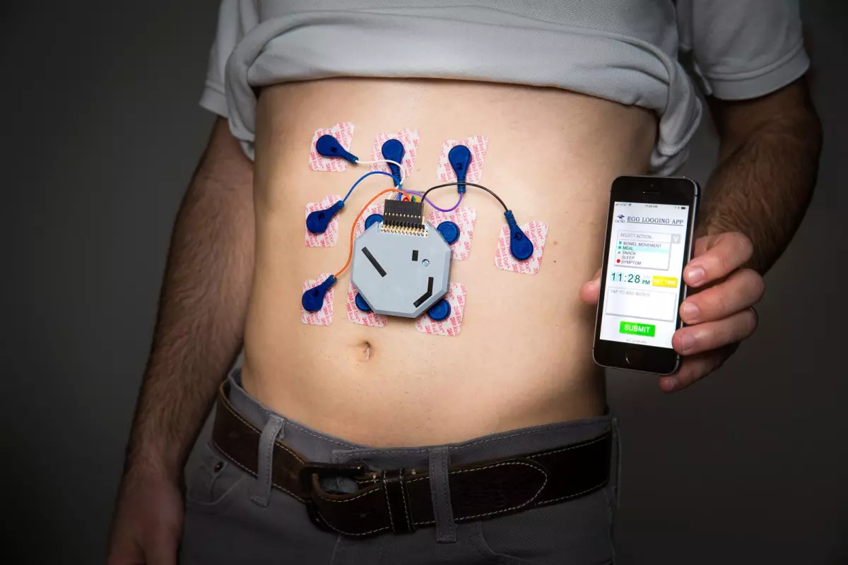 The system is worn by patients for a 24-hour period, as they perform their usual activities