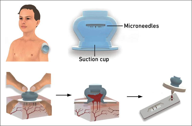 A diagram illustrating how the device would be used in practice